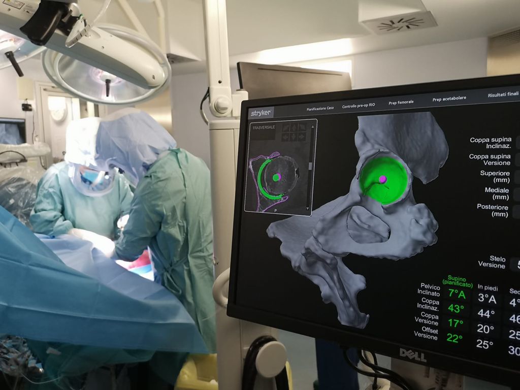 Gli ultimi sviluppi della chirurgia ortopedica robotica raccontati dal Dottor Perazzini
