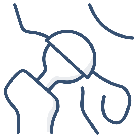 Artroprotesi d’Anca Robotizzata