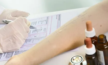 Allergie, torna la settimana dedicata alla diagnosi e alla prevenzione