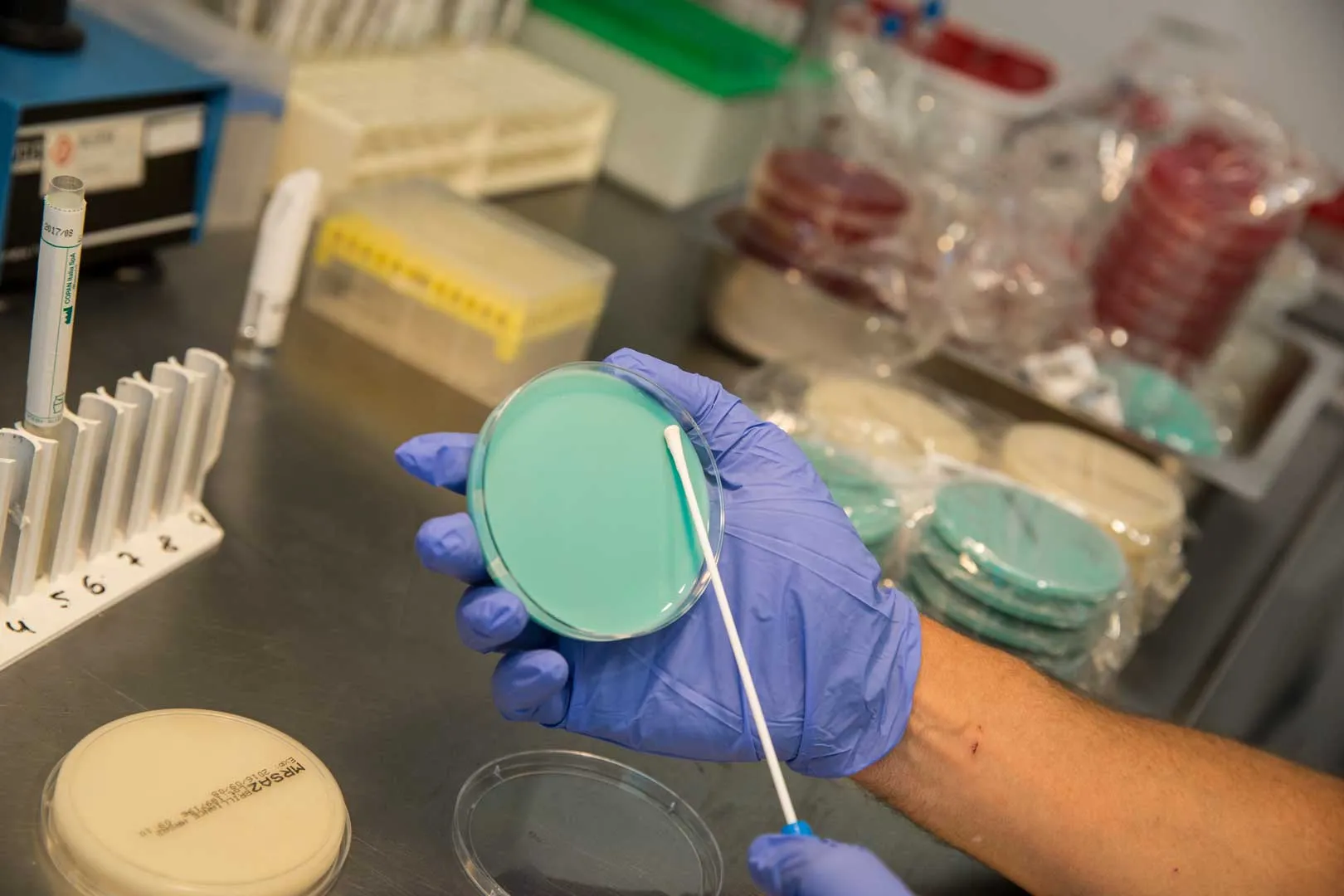 Test e Tamponi per la rilevazione del Virus SARS-Cov-2