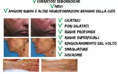 Laser Eco2 Plus al Poliambulatorio Marca Trevigiana 