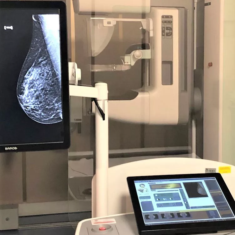 Il percorso senologico per la diagnosi precoce del tumore alla mammella