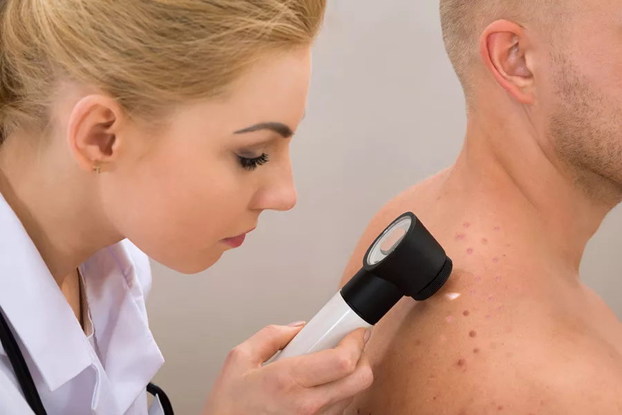 Conoscere e riconoscere il melanoma