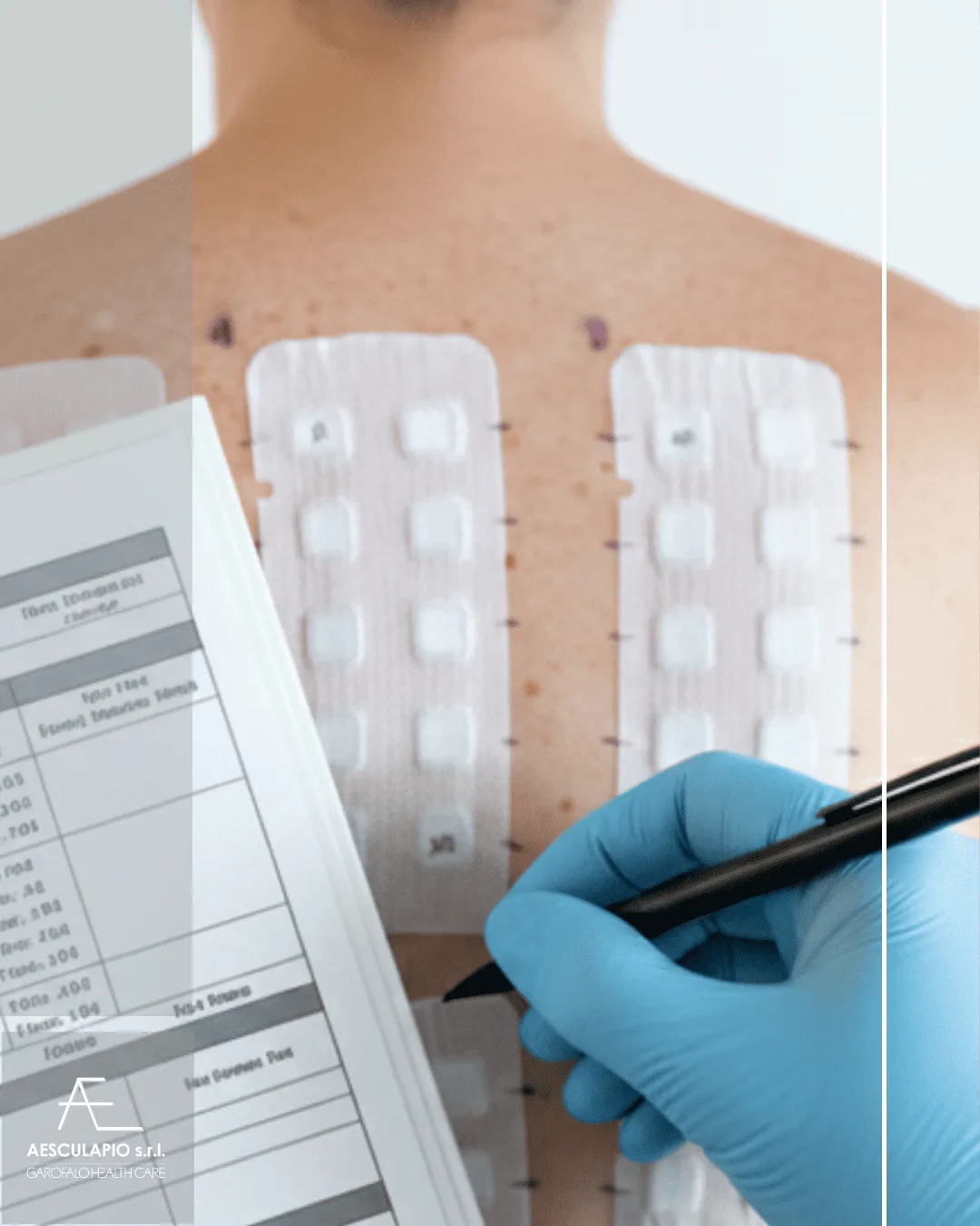 Patch test dermatologico: un nuovo servizio nel nostro Poliambulatorio 
