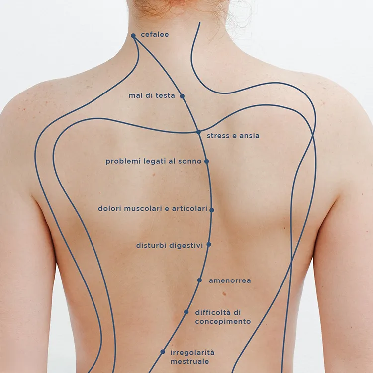 Agopuntura: il benessere che parte dal corpo e arriva alla mente!  