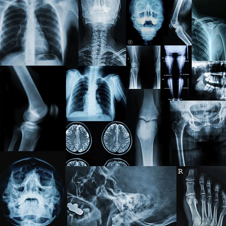Tutto quello che c’è da sapere sugli esami radiologici 